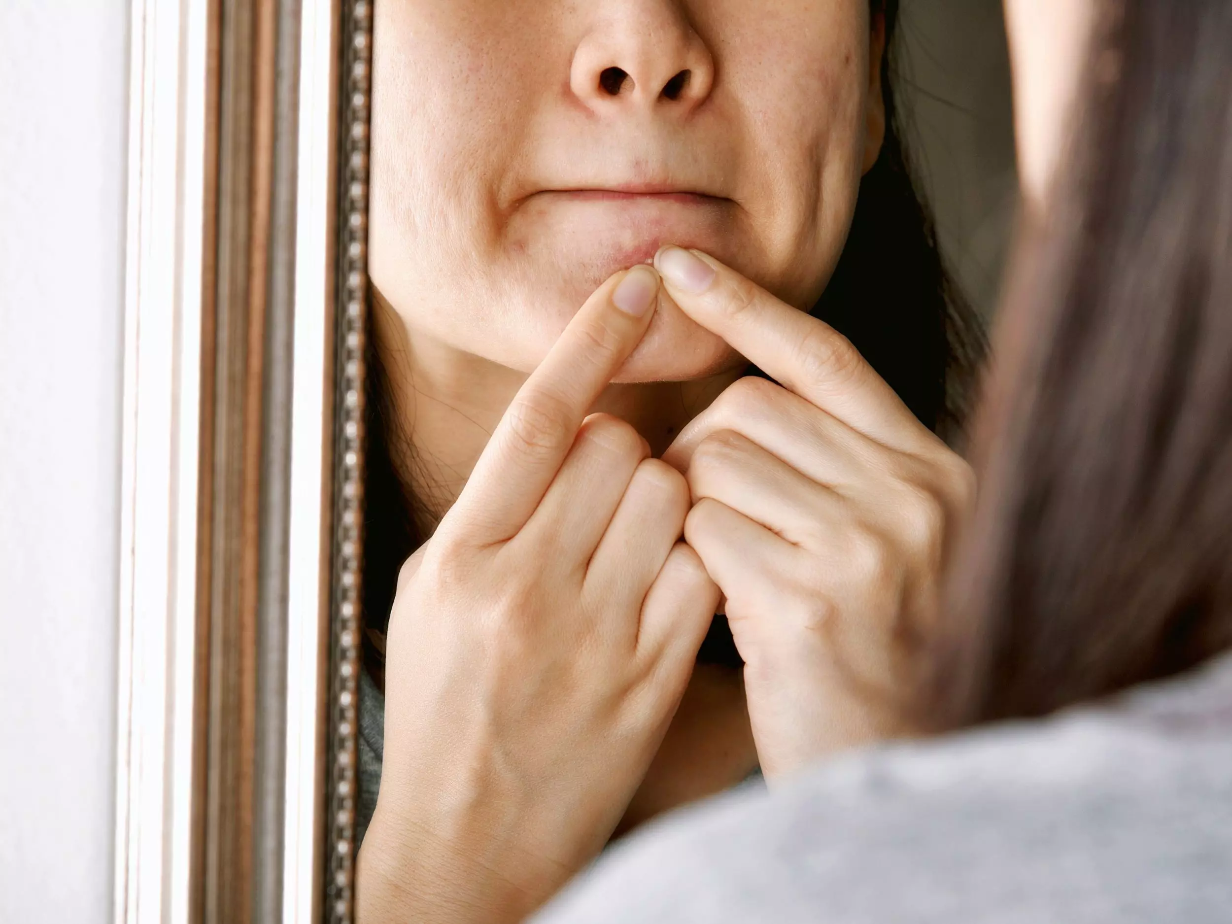 Eine Frau drückt an einem Pickel an ihrem Kinn herum – typisch für Skin Picking, also das Quetschen, Reiben und Zupfen der Haut.