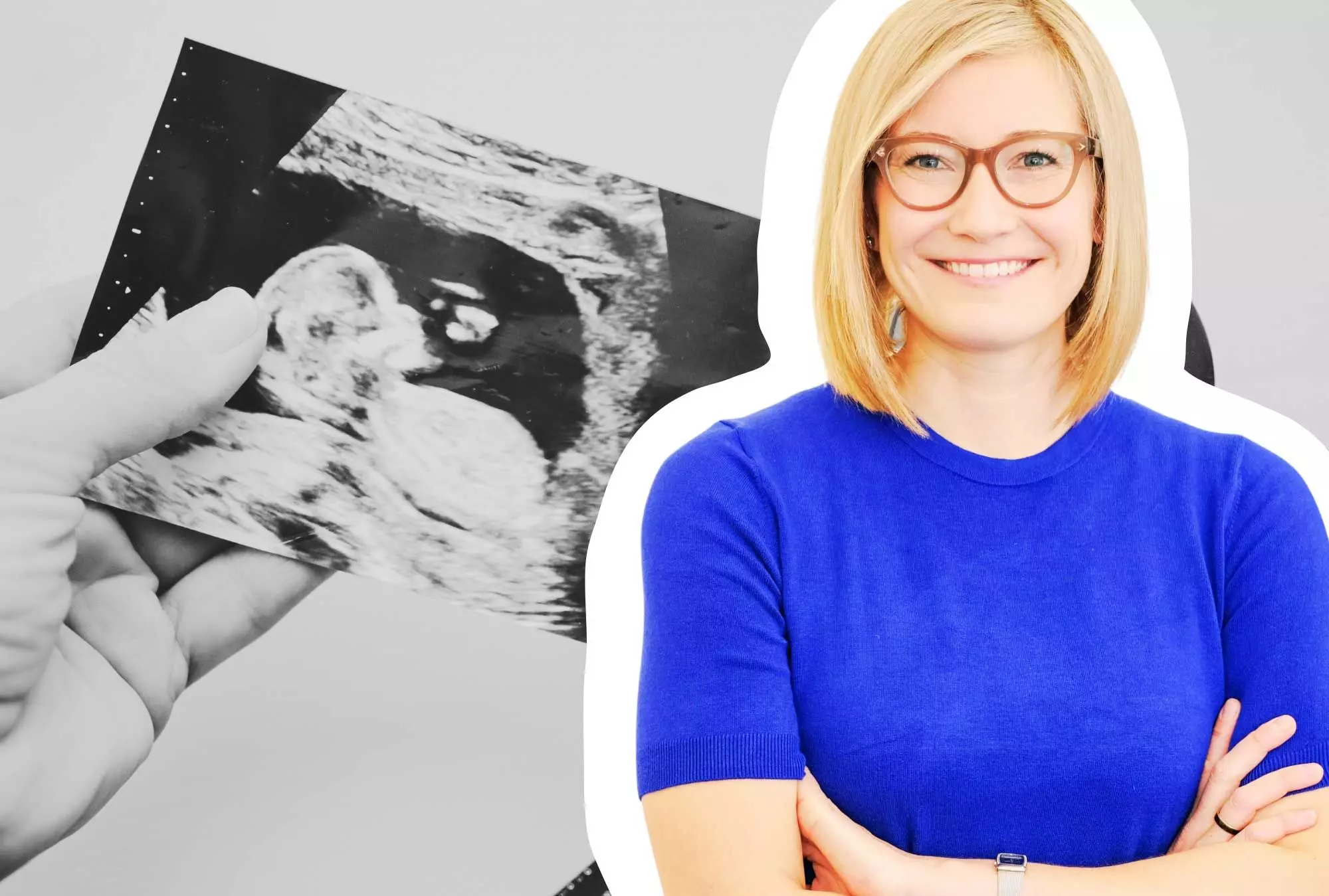 Sally Schulze hilft Paaren, die eine Fehlgeburt erleben
